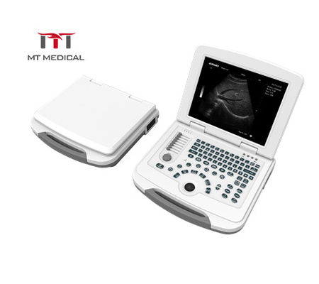 High Specification Portable Metal Laptop Ultrasound Scanner Machine