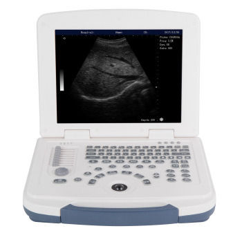 100% Guaranteed Portable Ultrasound Diagnostic System With Cheap Price Ultrasound Scanner