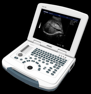 GYN Hot Sale Dw-580 China Ultrasound Machine For Diagnosis